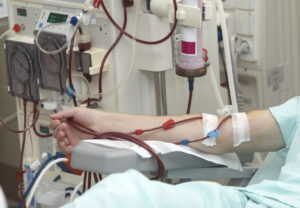 Image of country patient sitting in nephrology department at hospital to receive kidney dialysis. 